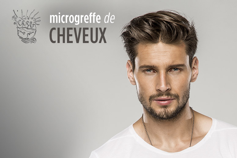 micro greffe de cheveux